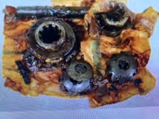 Kit pignons différentiel (woa6743)